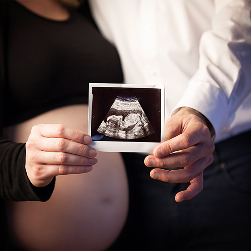 Foto von Eltern, die ein Ultraschallfoto halten